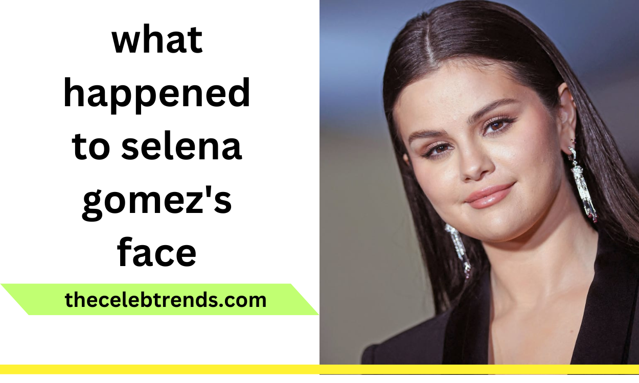 what happened to selena gomez's face