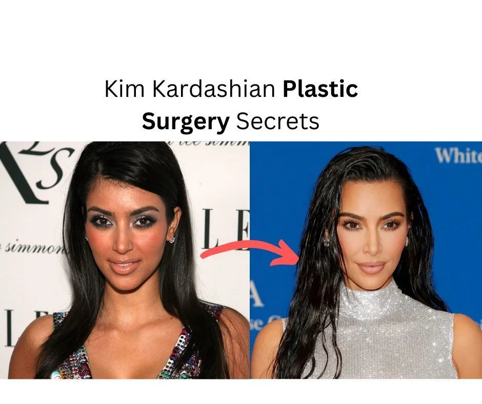  kim kardashian before and after Plastic Surgery Journey